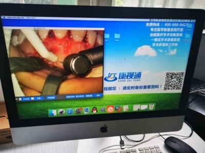 4Kg(sh)D(zhun)ʾֱϵy(tng)